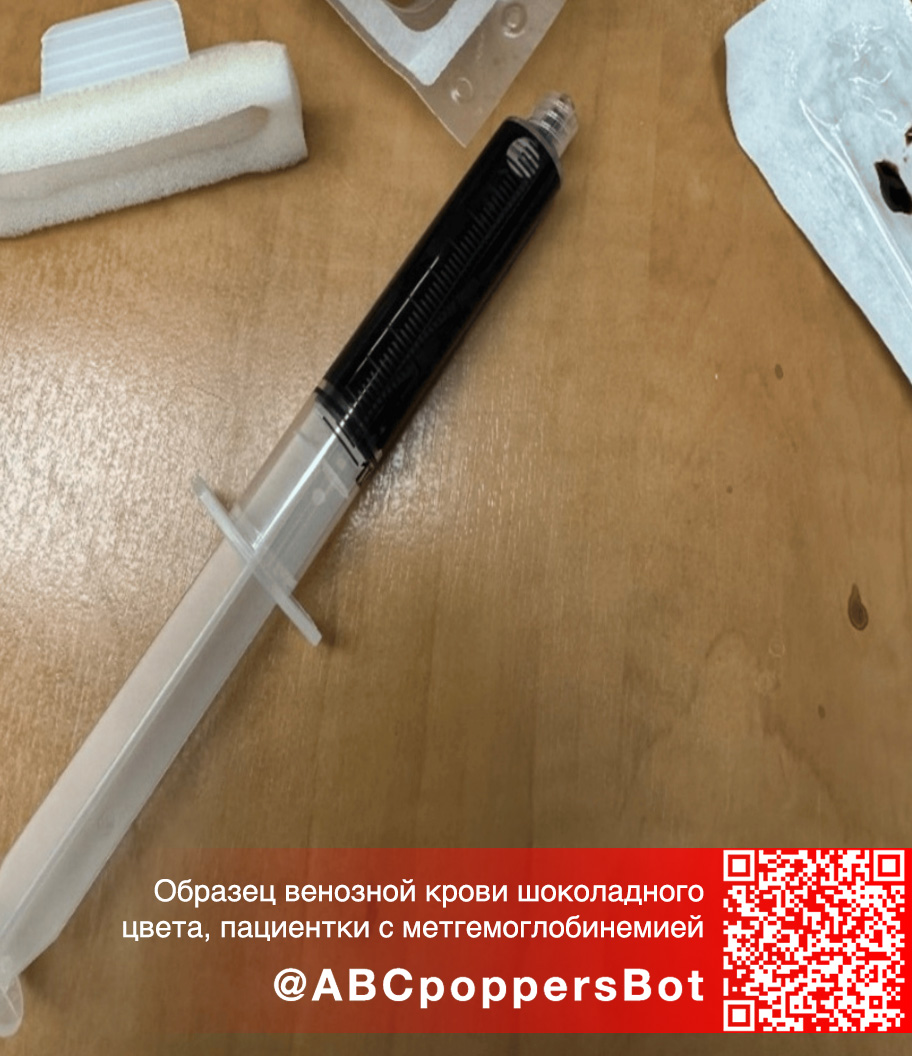 Если принять попперс внутрь в Владивостоке это вызывает метгемоглобинемию. Смертельное состояние Если принять попперс внутрь в Владивостоке это вызывает метгемоглобинемию. Смертельное состояние